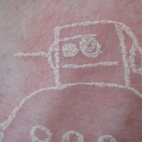 Laser Tattoo