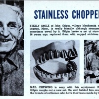 Stainless steel teeth