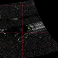 Receiving weather satellite transmissions