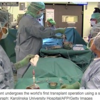 News From The Future: Synthetic organ transplants