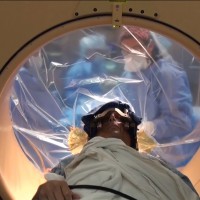 Better 3D Imaging Aids Surgery for Deep Brain Stimulation