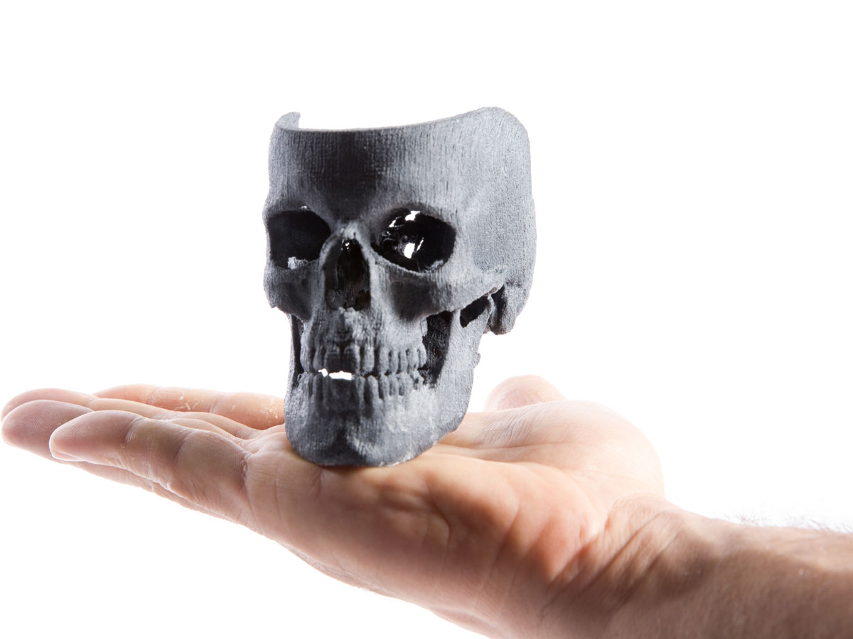 3D Print Your Medical Scan