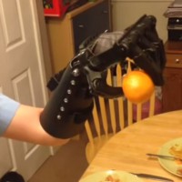 Unboxing My Son’s New 3D-Printed Hand
