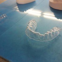 Can You Fix Your Own Teeth with 3D Printed Retainers?